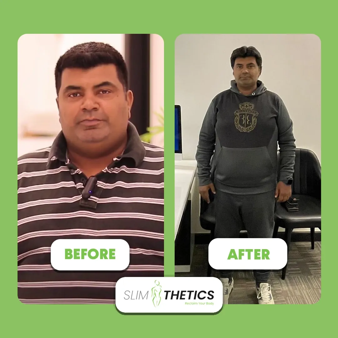 Bilal M. — Sleeve Gastrectomy patient at JJ Aesthetics Islamabad