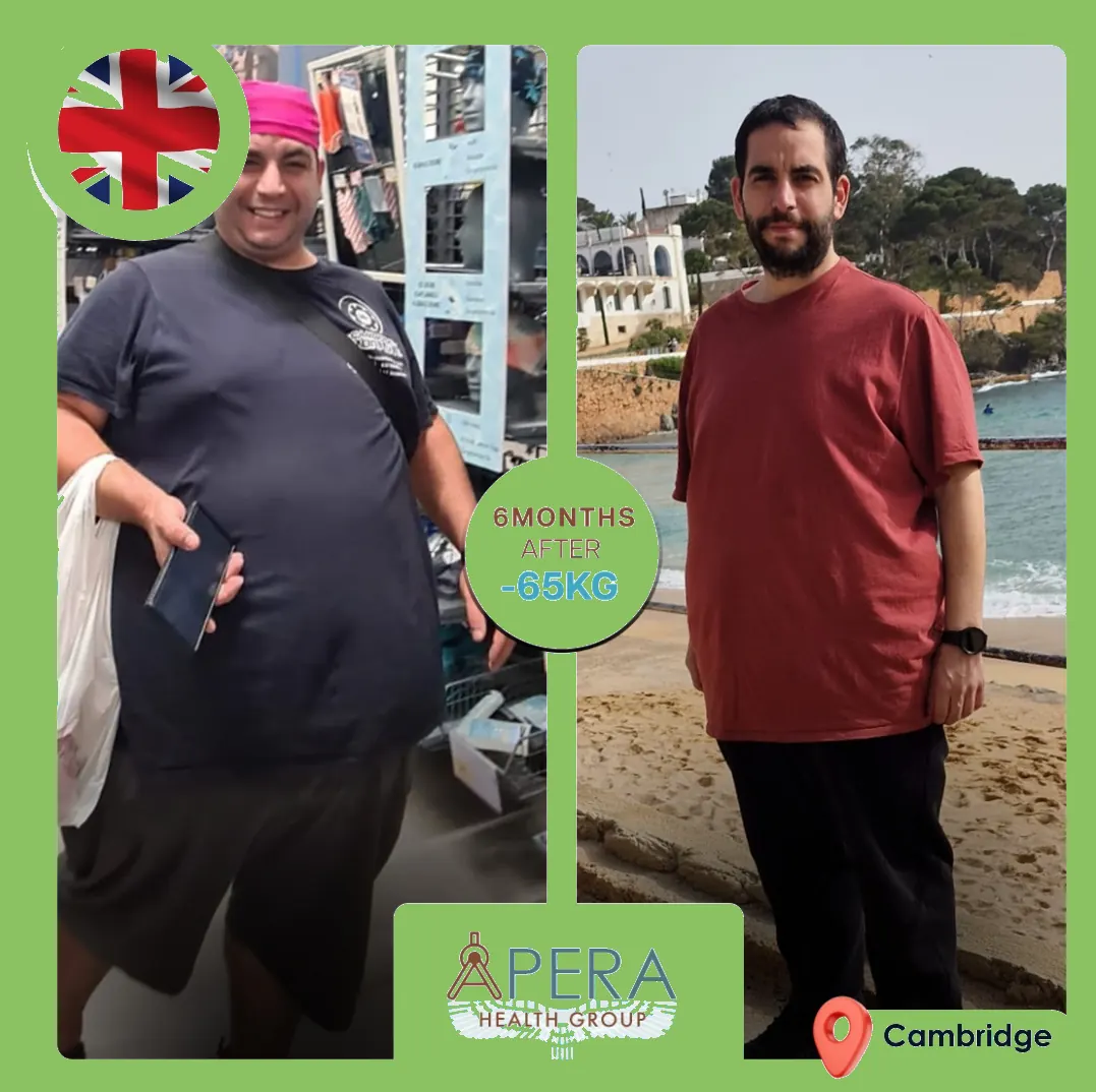 Bariatric surgery journey before and after — Lost 65kg in 6 months