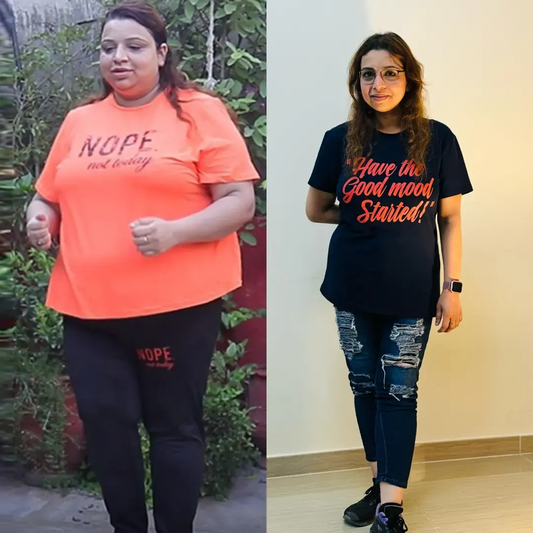 Zara F. — Gastric Balloon patient at JJ Aesthetics Islamabad
